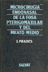 Microcirugia endonasal de la fosa pterigomaxilar y del meato medio