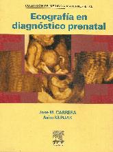 Ecografia en Diagnostico Prenatal