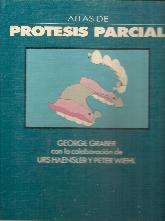 Atlas de protesis parcial