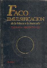 Facoemulsificacion: De Lo Basico A Lo Avanzado