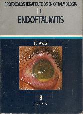 Endoftalmitis, protocolos terapeuticos en oftalmologia