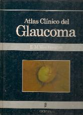 Atlas clinico del glaucoma
