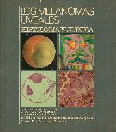 Los melanomas uveales