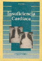 Insuficiencia cardaca