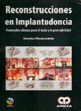 Reconstrucciones en implantodoncia