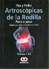 Artroscpia de la Rodilla. Tips y Perlas