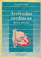 Arritmias cardiacas