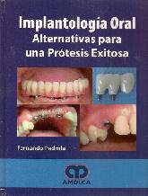 Implantologa Oral