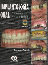Implantologa oral