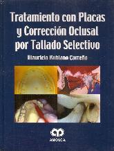 Tratamiento de Placas y Correccin Oclusal por Tallado Selectivo