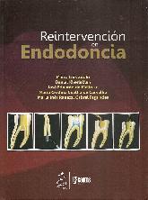 Reintervencin en Endodoncia