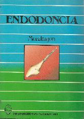 Endodoncia