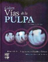 Cohen Vas de la Pulpa