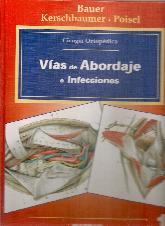 Vas de abordaje e infecciones - Volumen 1