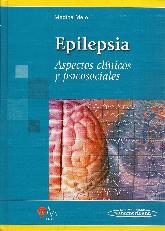 Epilepsia