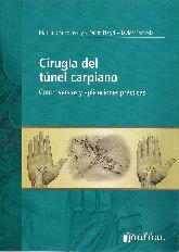 Ciruga del Tunel Carpiano