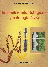 Implantes Odontolgicos y Patologa sea