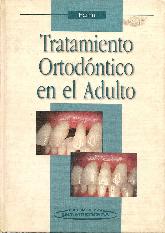 Tratamiento ortodontico en el adulto