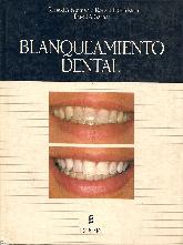 Blanqueamiento dental