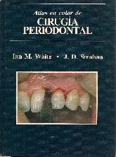 Cirugia periodontal