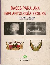 Bases para una implantologia segura