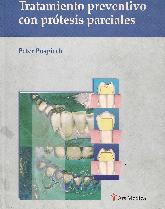 Tratamiento peventivo con protesis parciales