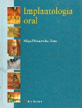 Implantologia oral