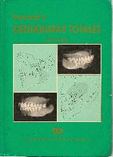 Dentaduras totales