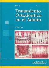 Tratamiento Ortodntico en el Adulto