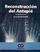 Reconstruccin del Antepi