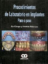 Procedimientos de Laboratorio en Implantes