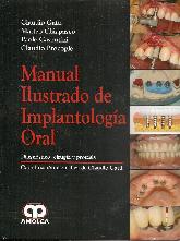 Manual Ilustrado de Implantologa Oral