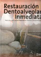 Restauracin Dentoalveolar Inmediata