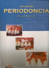 Atlas de Periodoncia