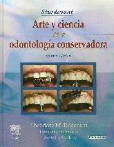 Arte y Ciencia de la Odontologia Conservadora