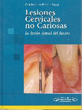 Lesiones Cervicales No Cariosas