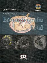 Ecocardiografa Fetal