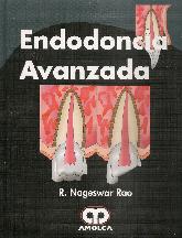 Endodoncia Avanzada