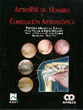 ArtroRM del Hombro y Correlacion Artroscopica