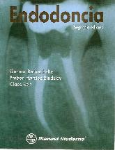 Endodoncia