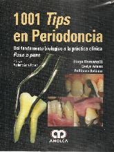 1001 Tips en Periodoncia