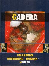 Cadera Callaghan