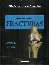 Fracturas