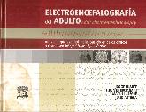 Electroencefalografa del Adulto