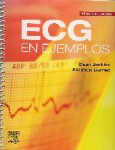 ECG en Ejemplos