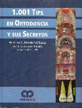 1001 Tips en Ortodoncia y sus Secretos