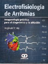 Electrofisiologa de Arritmias