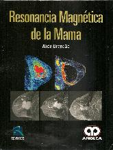 Resonancia Magntica de la Mama