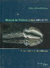 Manual de Protesis sobre Implantes