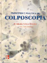 Principios y Prctica de Colposcopia